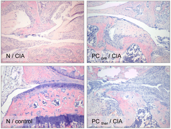 Photomicrographs with inflammatory reactions in knee joints of animals from groups 1 to 4. Photomicrographs of knee joints from groups 1 to 4 (H & E staining). N/CIA: group 1 (collagen-induced arthritis (CIA) + normal diet (N)) with synovitis, leukocyte infiltration and moderate cartilage erosions (original magnification ×10). PCpre/CIA: group 2 (CIA + pretreatment with the phosphatidylcholine-enriched diet) with moderate inflammatory reactions and slight damage to the cartilage (original magnification ×10). N/control: group 4 (control group with the normal diet), a knee joint with intact structure (original magnification ×10). PCther/CIA: group 3 (CIA + the phosphatidylcholine-enriched diet started with the clinical onset of the disease) with serious inflammatory reactions, extensive cartilage destruction and subchondral bone damage (original magnification ×10). Group 5 (PCpro/control) is not presented since no relevant difference was found in the histological appearance of the two control groups.