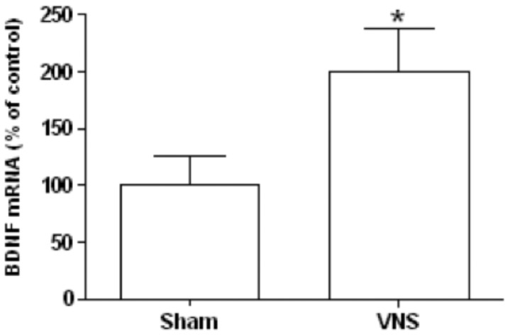Effect of chronic VNS on the amount of BDNF mRNA in the hypothalamus.The abundance of BDNF mRNA in the hypothalamus was determined by RT and real-time PCR analysis for rats treated with VNS for 4 weeks and for sham-operated controls. Data were normalized by the amount of βIV-tubulina mRNA, are expressed as a percentage of the value for sham-operated controls, and are means ± SEM for nine animals per group. *P<0.05 versus sham-operated controls (Scheffe’s test).