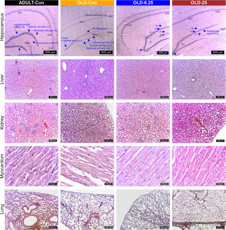 Histopathological assessment of the examined cannabinoids effects on selected internal organs. The chronic, intermittent administration of Cannabixir® Medium Flos did not result in significant changes in hematoxylin–eosin staining of key organs including lungs, myocardium, kidneys, and liver in the studied groups. Treatment group abbreviations: ADULT-Con: the young adult control group; OLD-Con: the naturally aged control group; OLD-6.25: the Cannabixir® Medium Flos 6.25 mg/kg naturally aged group; and OLD-25: the Cannabixir® Medium Flos 25 mg/kg naturally aged group; DG: dentate gyrus