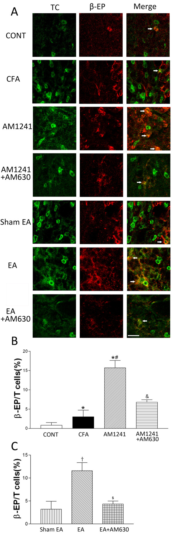 Effects of AM1241, EA, AM1241 plus AM630, and EA plus AM630 on T-lymphocytes with β-endorphin immunorecativity in the skin tissues. A, representative confocal images show TCR-positive T-lymphocytes (TC, green, left panels) and β-endorphin-immunoreactive cells (β-EP, red, middle panels). The right panels are overlay images showing T-lymphocytes labeled with β-endorphin (Merge, yellow, white arrows). Images include vehicle control (CONT), CFA+vehicle of AM1241 (CFA), CFA+AM1241 (AM1241), CFA+AM1241+AM630 (AM1241+AM630), CFA+sham EA+vehicle of AM630 (sham EA), CFA+EA+vehicle of AM630 (EA), and CFA+EA+AM630 (EA+AM630) groups (Scale bar, 50 μm). B-C, summary graphs show the percentage of double-labeled T-lymphocytes labeled with β-endorphin (β-EP) in the total of TCR-positive T-lymphocytes in the skin tissues. Data are expressed as means ± SEM (n = 6 rats in each group). * P < 0.05, compared with the vehicle control group; # P < 0.05, compared with the CFA+vehicle of AM1241 group; & P < 0.05, compared with the CFA+AM1241 group; †P < 0.05, compared with the CFA+sham EA+vehicle of AM630 group; $ P < 0.05, compared with the CFA+EA+vehicle of AM630 group (One-way ANOVA followed by Tukey's test).