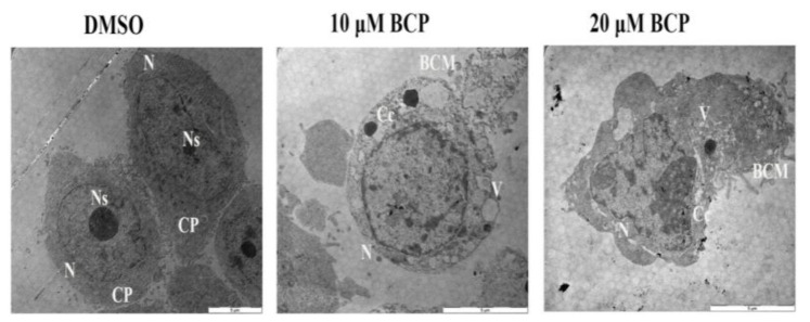 Ultrastructural micrographs using the TEM showing the apoptotic features of HCT 116 cells treated with BCP. HCT 116 cells treated with vehicle (0.5% DMSO) revealed intact cell membrane, normal cytoplasm (CP) with clear nucleus (N), and nucleolus (Ns). In contrast, BCP-treated cells revealed numerous cytoplasmic vacuoles (V), blebbing of the cell membrane (BCM), chromatin condensation (Cc), and disappearance of the nucleolus (Ns), suggesting the features of apoptotic cell death. The pictures were taken after 24 h treatment of vehicle or BCP at 1600× magnification.