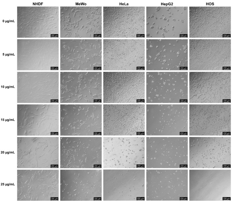 Morphological analysis of normal dermal fibroblasts (NHDF), malignant melanoma (MeWo), adenocarcinoma (HeLa), hepatocellular carcinoma (HepG2) and osteosarcoma (HOS) cells treated with CBD-enriched hemp oil at 5, 10, 15, 20 and 25 µg CBD/mL for 48 h. Control cells were incubated with complete cell culture medium (represented as 0 µg CBD/mL).