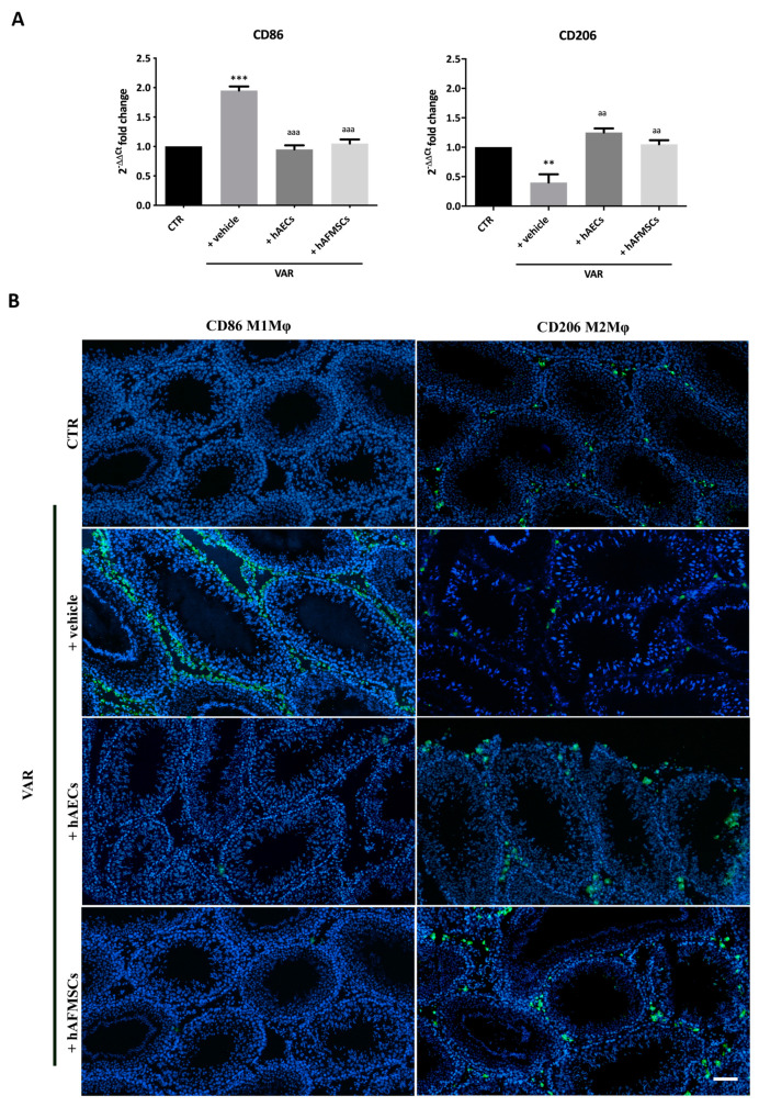CD86 proinflammatory M1Mφ and CD206 anti-inflammatory M2Mφ subpopulations in varicocele-treated testes. (A) Gene expression profile of proinflammatory CD86 and anti-inflammatory CD206 markers carried out in CTR and VAR treated rats (+vehicle, +hAECs and +hAFMSCs). Data are the mean values ± SD obtained from at least n = 3 independent experiments. Values statistically different for ** p < 0.005, and *** p < 0.001 vs. CTR; aa p < 0.005, aaa p < 0.001 and vs. +vehicle group. (B) Representative images of macrophages infiltration in rat testes. CD86 and CD206 positive cells were identified by green fluorescence while the nuclei were counterstained with DAPI. Scale bar: 100 μm.