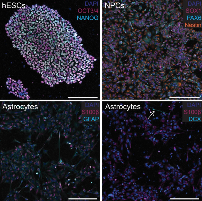 Validation of cell differentiation. Stem cells show positive staining for OCT3/4 and NANOG (top left), and neuronal precursor cells stain positive for Nestin, SOX1, and PAX6 (top right). Astrocytes show positive staining for S100β and GFAP (bottom left) with little to no DCX (bottom right). A single cell showing neuronal differentiation is indicated by white arrow (bottom right). Scale bars = 200 μm. Individuals panels for each stain are shown in Figs. S1, S2, and S3 for stem cells, neural progenitors, and astrocytes, respectively
