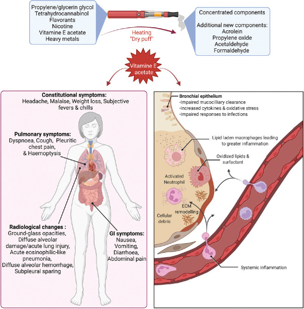 Overview of primary confounding factors of EVALI. Created with BioRender.com. EVALI: e-cigarette, or vaping, product use-associated lung injury