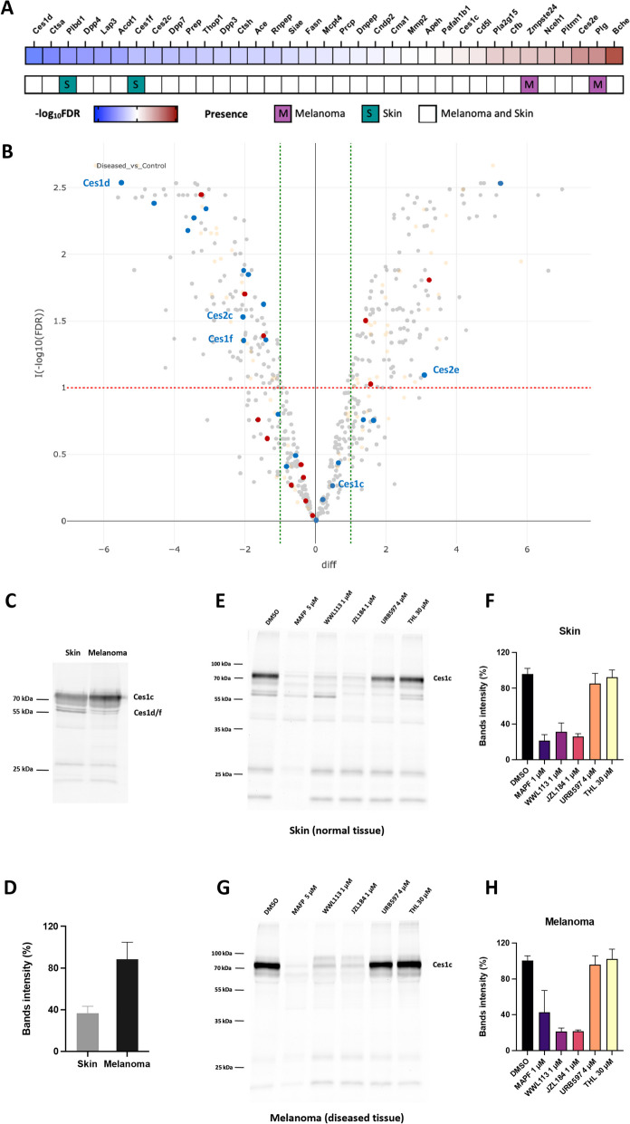 Serine hydrolases found in melanoma and normal skin tissues. A Heatmap depicting the − log10 transformed False Discovery Rate (FDR) of the differential expression analysis of serine hydrolases between mouse melanoma and skin. Red color indicates positive (> 0), white color indicates zero (0), blue color indicates negative (< 0) expression differences and the color intensity represents variation in the levels across the color scale. Pink color represents proteins present only in melanoma; green color represents proteins present only in the skin. B Volcano plot showing − log10 transformed FDR of the differential analysis between Diseased (melanoma) and Control (skin) groups. Red line indicates the − log10(FDR) of FDR = 0.1, green lines indicate the difference of −1 and + 1. Differences and FDRs estimated using missing value imputation are shown in orange. Metabolic serine hydrolases are shown in blue; serine proteases are shown in red. Isoforms of Ces1 and Ces2 are indicated on the graph. C Representative gel-based ABPP of mouse melanoma and skin samples. Samples were incubated with the activity probe TAMRA-FP (125 nM) for 30 min at RT. D Quantification of Ces1c band intensity from the gel-based ABPP. Data are shown as mean ± SD from three independent experiments. Representative gel-based ABPP of mouse skin (E) and melanoma (G) samples. Samples were incubated with the indicated concentrations of MAPF, WWL113, JZL184, URB297, and THL for 30 min at RT before incubation with the activity probe TAMRA-FP (125 nM) for 30 min at RT. Quantification of Ces1c band intensity from the gel-based ABPP of mouse skin (F) and melanoma (H) samples. Data are shown as mean ± SD from four independent experiments, performed in triplicates. Abbreviations: M – melanoma, S – skin