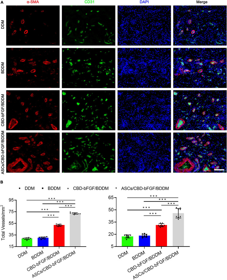 (A) Double immunofluorescent staining for CD31 and αSMA in wounds covered with decellularized dermal matrix, book-shaped decellularized dermal matrix (BDDM), collagen-binding domain (CBD)–basic fibroblast growth factor (bFGF)/BDDM, adipose-derived stromal cells/CBD–bFGF/BDDM at day 7 post-wounding. Bar = 50 μm. (B) Quantitative analysis of the number of total blood vessels and mature blood vessels in wounds at day 7 post-wounding. Data are shown as means ± standard deviation (*P < 0.05, **P < 0.01, and ***P < 0.001).
