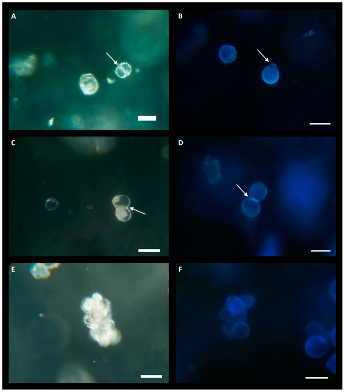 Protoplasts at various growth stages while cultured in low-melting-point agarose beads consisting of KM5/5 +10 µM AIP media at a density of 2.0 × 105 protoplasts/mL. (A,C,E) are imaged under bright field. (A,C) were taken 6 days post-culture and (D) was taken 19 days post-culture. (B,D,F) are stained with calcofluor white, 3 weeks post-culture; blue florescence indicates cell wall formation. (A) The white arrow indicates the nascent cell wall during protoplast division. (B) Two protoplasts with blue florescence indicating the regeneration of cell walls. The white arrow indicates the location of the protoplast bulging, indicative of the beginning of cell division. (C) Protoplast undergoing division as seen by the formation of a cell wall (white arrow) next to an undivided protoplast (center-left). (D) Calcofluor stain of a dividing protoplast; the white arrow indicates bright-blue fluorescence at the formation of a new cell wall in the daughter cells. (E) Center shows a microcallus produced from successive protoplast divisions. (F) Calcofluor-stained microcallus. Scale bar = 50 µm.