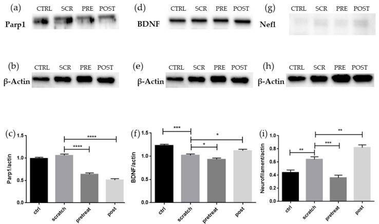 (a) Evidence of significant reduction of Parp1 after treatment with CBG, suggesting decreased apoptotic signal. (b) β-Actin signal used for normalization. (c) Densitometric analysis of Parp1, **** p < 0.0001. (d) Evidence of significant reduction of BDNF level in scratched cells and increase level in post-treated cells, indicating a positive regenerative and survival signal in post-treated cells. (e) β-Actin signal used for normalization. (f) Densitometric analysis of BDNF, * p < 0.005, *** p < 0.0005. (g) Evidence of significant increase of Nefl protein in scratched cells and in post-treated cells, while pre-treated cells decrease their Nefl level, suggesting an ongoing axonal regeneration in post-treated cells. (h) β-Actin signal used for normalization. (i) Densitometric analysis of Nefl, ** p < 0.001, *** p < 0.0005. CTRL: control; SCR: scratched cells; PRE: pre-treated cells; POST: post-treated cells.