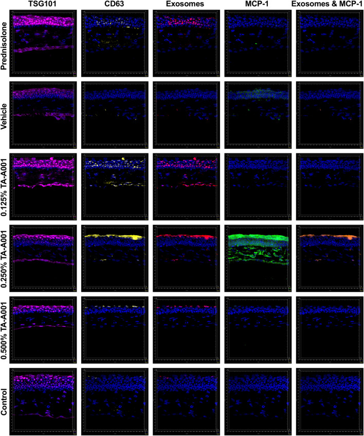 Secretion of extracellular vesicle markers, TSG101 (magenta) and CD63 (yellow), and monocyte chemoattractant protein-1 (MCP1; green) by alkali burned mouse corneas treated with one of prednisolone, drug vehicle or TA-A001. Colocalized channels of TSG101 and CD63 are indicators of exosomes (red). Brown staining shows colocalization of exosomes with MCP-1. All images were taken at the same magnification with scale bar representing 20 μm.