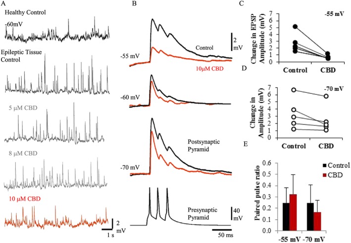 CBD dampens excitation. (A) Spontaneous EPSPs, recorded at a membrane potential of −60 mV in healthy control tissue and KA model of epileptic tissue. Concentrations of 5, 8 and 10 μM CBD were bath‐applied. sEPSP frequency and peak amplitudes were only significantly changed with 10 μM of CBD. (B) Unitary recording between two pyramidal cells synaptically connected. Triple presynaptic action potentials elicited by the pyramidal cell resulted in EPSPs that displayed synaptic depression recorded at three different membrane potentials (−70, −60 and −55 mV). These EPSPs were reduced in amplitude and duration following bath application of 10 μΜ CBD (red traces). (C, D) Plots of change in peak average amplitude of EPSPs per synaptic connection (n = 5) with bath application of CBD recorded at −55 and −70 mV. CBD had a more pronounced action at more positive membrane potentials. (E) Plot of PPR (second‐amplitude EPSP/first‐amplitude EPSP) at −55 and −70 mV; no significant change in PPR was measured in CBD‐treated cells.