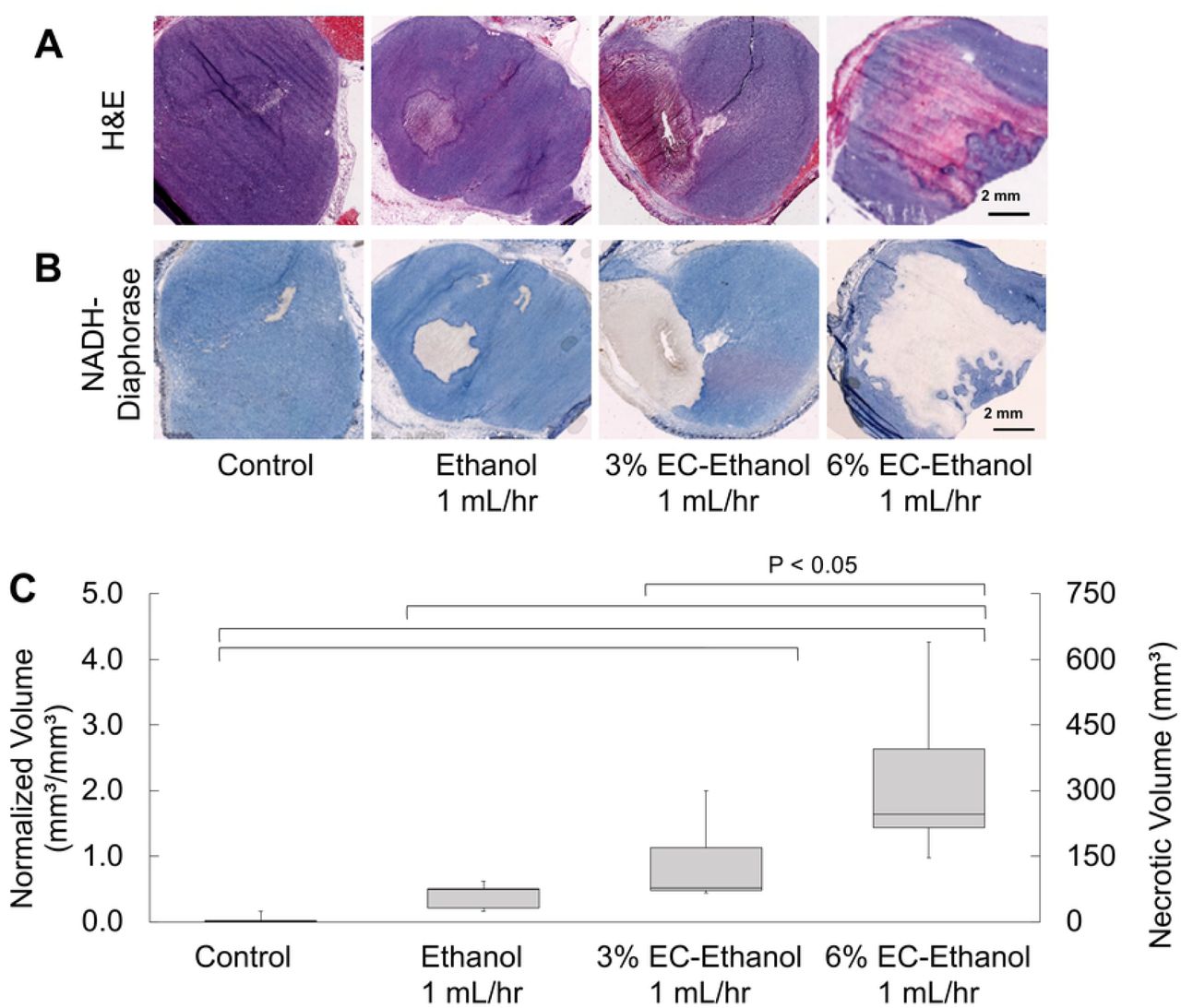 Relationship between EC-ethanol Concentration and Necrosis.Representative images of (A) H&E stained sections and (B) adjacent NADH-diaphorase stained sections from frozen blocks. (C) Ratio of necrotic volume to injected volume (normalized volume) after injection of 150 μL of pure ethanol at 1 mL/hr (n=5), 3% EC-ethanol at 1 mL/hr (n=5), or 6% EC-ethanol at 1 mL/hr (n=5). * P<0.05 using Tukey’s HSD test.
