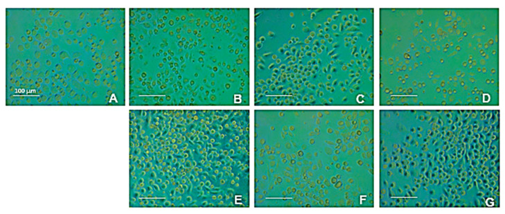 The figure shows a typical experiment. U937 cells are treated with different concentrations of the stimuli, proteins (B–D) and hydrolysates (E–G). Image (A) represents untreated control. The cells were treated with proteins (B–D), 0.1, 0.01, and 0.001 mg/mL, respectively, and with hydrolysates (E–G), 0.1, 0.01, and 0.001 mg/mL, respectively (magnification 20×, scale bar = 100 μm).