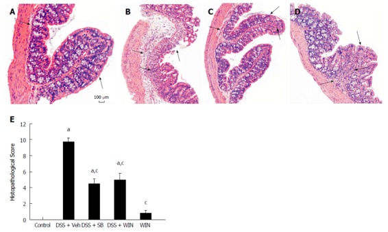 Histopathological score of dextran sulfate sodium-induced colitis in C57BL/6 mice. A: Control; B: Dextran sulfate sodium (DSS) + vehicle (Veh); C: DSS + SB203580 (SB); D: DSS + WIN (WIN55). Arrows marked in the figure (HE-staining, magnification × 100, respectively) point to the damage in epithelium, or edema in the sub-mucosa, or infiltration of inflammatory cells; E: Histopathological score (HS) was calculated as described in the Materials and Methods. Data of HS are presented as mean ± SEM (n = 8). aP < 0.05 vs control; cP < 0.05 vs DSS + Veh.