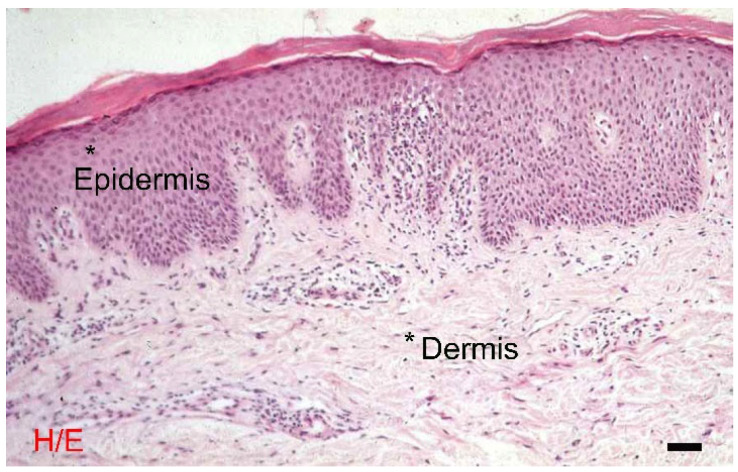 The skin: Morphological differences between the epidermis and the dermis. Light microscopy, hematoxylin and eosin, scale bar = 100 μm [15]. * Epidermis, * Dermis.
