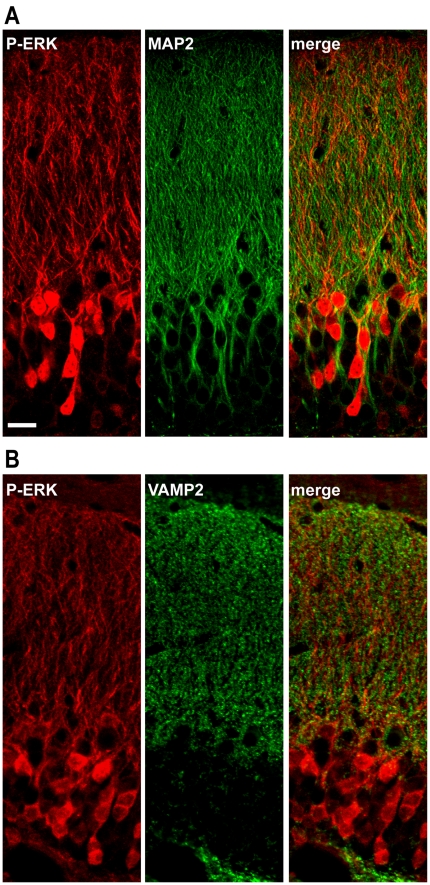 SKF 81297-induced ERK phosphorylation occurs at the postsynaptic level.(A and B) Single confocal sections showing P-ERK) (red) and MAP2 (green, upper panel) or VAMP2 (green, lower panel) immunofluorescence in the dentate gyrus of mice 15 min after SKF 81297 (5.0 mg/kg, i.p.). Note that P-ERK immunoreactive neurons are observed in MAP2-positive cells, suggesting that ERK activation induced by SKF 81297 occurred mainly at the postsynaptic level. Scale bar: 20 µm.