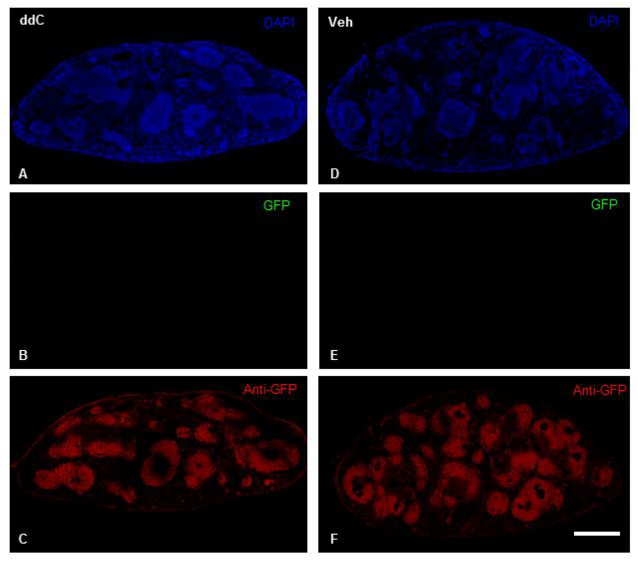 Anti-GFP-like immunoreactivity is detectable in the spleens of CB2f/f mice.Robust anti-GFP-like immunoreactivity was located in the spleens of CB2f/f mice treated with ddC (A, C) or vehicle (D, F). Sudan black treatment quenched native eGFP expression (B, E). Scale bar equal to 1 mm.