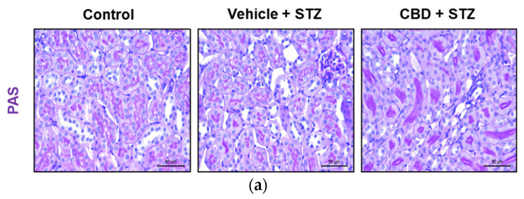CBD worsens STZ-induced renal lesions in tubules and interstice. (a) Representative images of kidney stained with PAS from control, vehicle-STZ, and CBD-STZ-treated mice (original magnification ×10, scale bar 50 μm). Quantification of (b) tubular and (c) interstitial lesion score. Values are expressed as mean ± SEM (n = 6–7 animals per group). ** p < 0.01, *** p < 0.001 vs. vehicle-citrate buffer-treated mice (control); # p < 0.05 vs. vehicle-STZ.