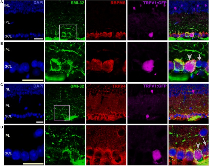 SMI-32+ RGCs coexpress TRPV1 and TRPV4 signals. (A) A representative TRPV1-expressing RGC is labeled by the GFP reporter that was immunopositive for SMI-32 and RBPMS. (B) Inset from A. (C) TRPV1-expressing RGCL neuron is labeled by SMI-32 and TRPV4 (D, arrowhead) antibodies. The arrow denotes a TRPV4- and SMI-32-immunonegative putative amacrine cell in the proximal INL. Pictures were obtained from one optical section. Scale bars = 20 μm.