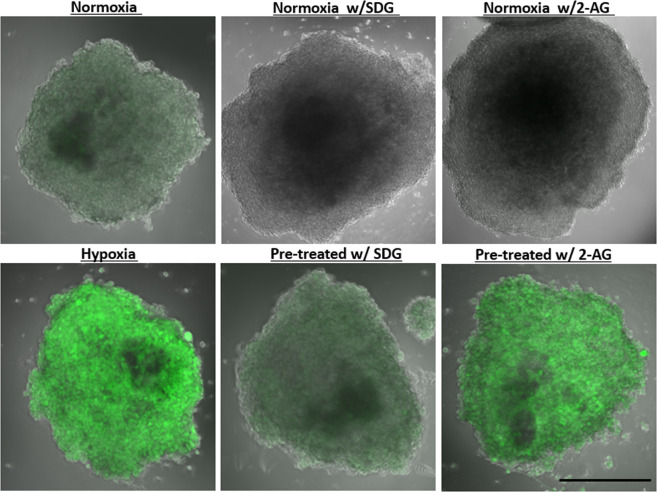 Treatment with Secoisolariciresinol diglucoside (SDG) decreased metabolic oxidative stress. Ten organoids were either treated with 50 µM SDG or 2- arachidonoyl glycerol 2-AG for 48 hrs prior to culturing in hypoxic chamber. Oxidative stress was then measured using oxidative stress reagent that produce a fluorescent product when it reacts with oxidative stress mediators. Four organoids from each group were then imaged using a scanning confocal microscope. SDG treatment reduced metabolic oxidative stress compared to organoids that were not treated prior to hypoxic incubation. Scale bars 300 μm.