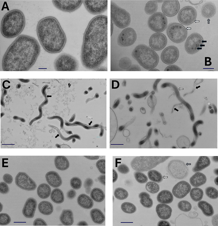 Electron micrographs displaying bacterial cell structures. Panels A and E show oval-shaped bacteria with defined cell walls. Panels B and F highlight various cell formations with arrows indicating specific features. Panels C and D depict spiraled bacteria with arrows pointing to notable structures. Blue scale bars are present in each image for size reference.