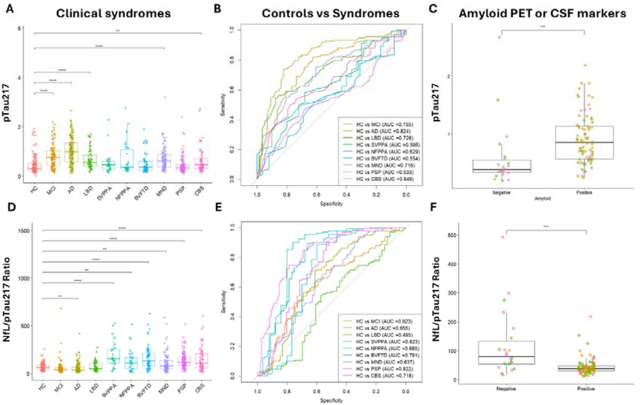 Plasma p-tau217 levels and NfL/p-tau217 ratio differentiate controls from patients with different diagnoses, and amyloid positive vs negative patients.