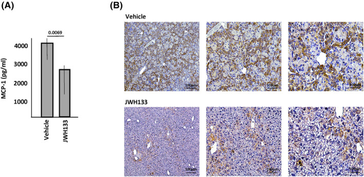 Treatment of Farber disease mice with a CB2R agonist. Two and one half‐month‐old Farber mice were treated with vehicle or JWH133 once weekly (10 mg/kg) for 6 weeks (n = 8/group) and (A) the levels of MCP‐1 were detected in plasma by ELISA or (B) in the liver by IHC. The p value is shown in (A) comparing vehicle and JWH133 treated mice (bar heights indicate the mean values from three independent experiments). Representative images are shown in (B). Brown staining indicates MCP‐1.