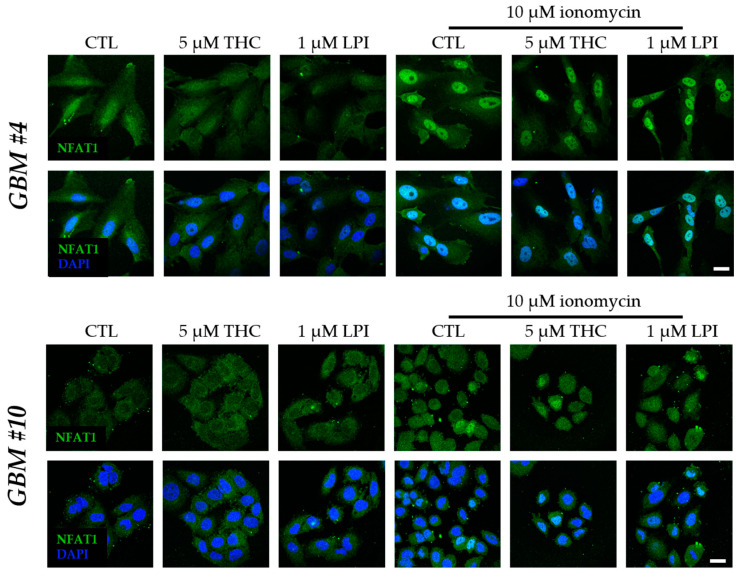 Influence of ionomycin on the subcellular localization of NFAT1 after 30 min in the presence of THC and LPI. THC and LPI had no effect on the subcellular localization of NFAT1 in GBM #4 and GBM #10. Ionomycin (Io) induced a marked translocation of NFAT1 into the nucleus after 30 min. In the presence of THC or LPI, ionomycin’s effects remained unchanged. Cell nuclei were counterstained with DAPI. Scale bar = 25 µm.
