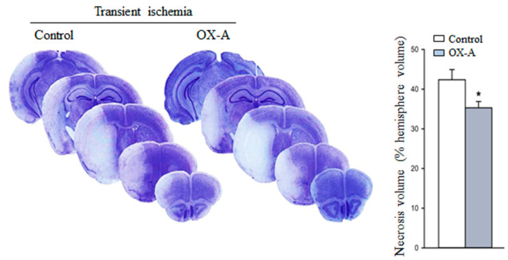 Systemic injection of OX-A reduces necrosis volume in the middle cerebral artery occlusion model of transient focal ischemia. Representative images of brain Nissl staining of male mice subjected to transient MCAO and treated i.p with saline or OX-A (40 µg/kg, injected 30 min before the onset of ischemia). Mice were killed 48 h after MCAO. Values of the infarct volume are mean ± SEM; n = 6 mice per group. Values were calculated by integrating the cross-sectional area of damage at each bregma level and the distances between the various levels and are expressed as the % necrotic volume of the entire right cerebral hemisphere. * p < 0.05 (Student’s t-test).
