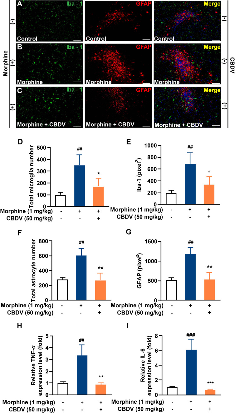 CBDV inhibits chronic morphine treatment-induced glial activation and pro-inflammatory factors IL-6 and TNF-α mRNA expression in NAc. (A–C) Representative double immunofluorescent staining images of Iba1 and GFAP for the control group (A), morphine group (B), and morphine + CBDV group (C). NAc regions were collected following the final behavioral testing shown in Figure 7B . (D, F) The quantification of microglia (D) and astrocytes (F). (E, G) The size of the microglia (E) and astrocytes (G). (H, I) Total RNAs were extracted and qRT-PCR was performed to measure the expression of TNF-α (H) and IL-6 (I) in NAc. Scale bar: 200 μm. All the data represented mean ± S.E.M. ## P < 0.01, ### P < 0.001 versus the control group; *P < 0.05, **P < 0.01, ***P < 0.001 versus the morphine group.