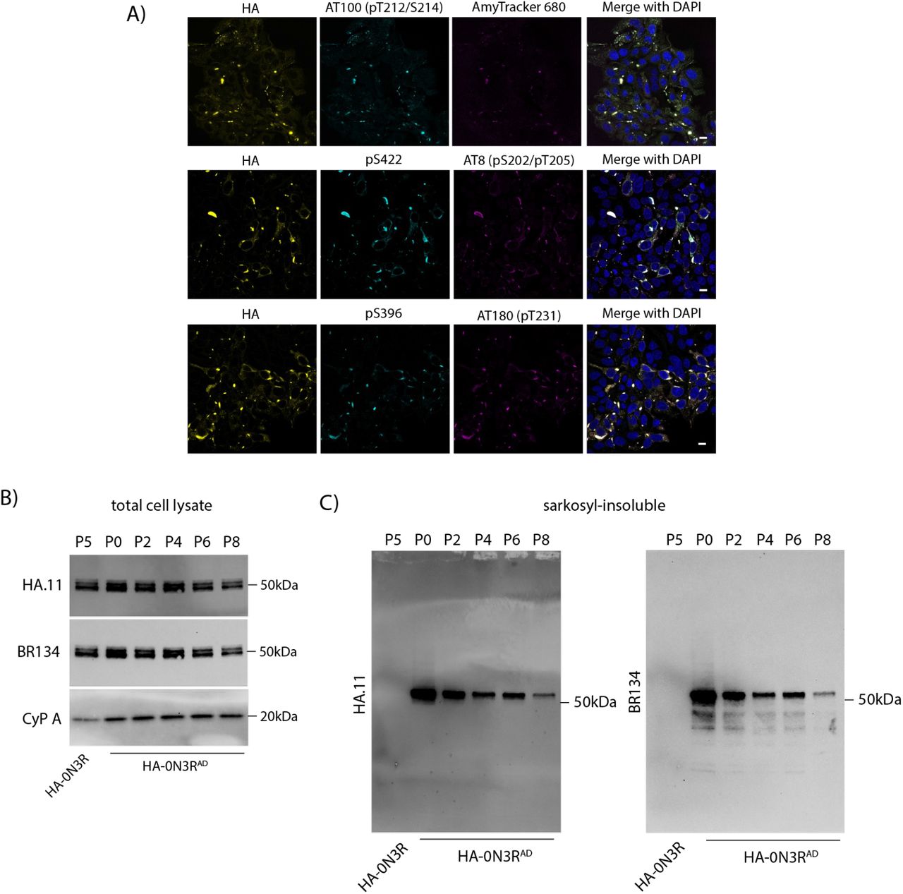 HA-0N3RAD HEK293 cells propagate AD-brain derived tau seeds. A) Representative immunofluorescent images of HA-0N3RAD cells at passage 4 (P4), probing with phosphorylation-specific antibodies: AT180, AT8, AT100, pS396, and pS422, and with an amyloid specific dye, Amytracker 680. sb = 10μm B). Immunoblot of total cell lysate of HA-0N3R at passage five (P5) and HA-0N3RAD cells over multiple passages. C). Immunoblot of the sarkosyl-insoluble fraction of HA-0N3R (P5) and HA-0N3RAD cells over multiple passages using a C-terminal tau antibody (BR134) and anti-HA antibody.