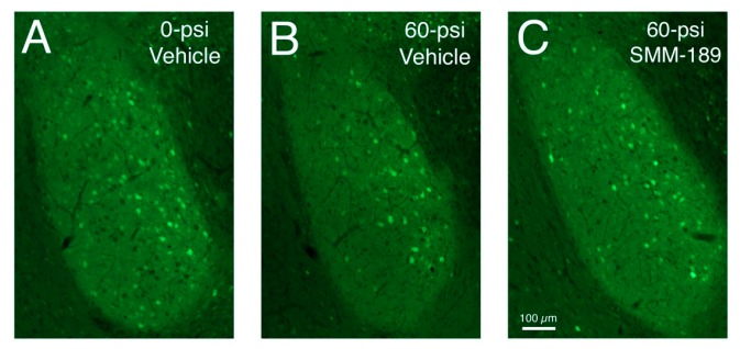 Images of sections through the basolateral amygdala on the blasted side from mice engineered to express enhanced yellow fluorescent protein (EYFP) in Thy1-enriched telencephalic neurons. Note that the basolateral amygdala (BLA) in the vehicle-treated 0-psi mouse (A) contains numerous Thy1-EYFP+ neurons, while the BLA in the vehicle-treated 50-psi mouse (B) contains fewer. Thy1+ neurons in BLA are increased in SMM-189-treated 50-psi mice (C) above that seen in the vehicle-treated 50-psi mouse.