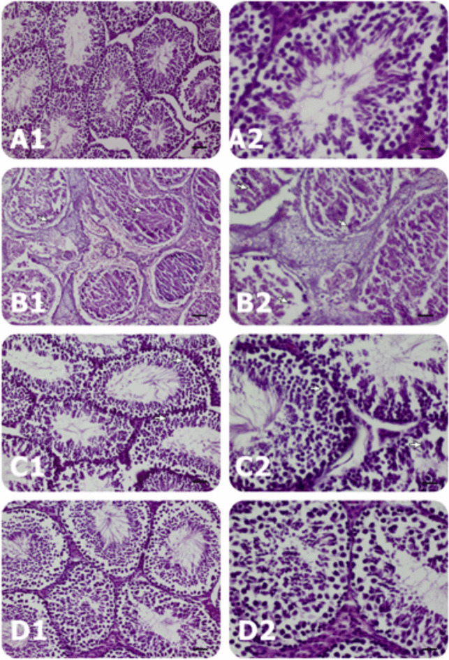 Histopathological findings in the groups. A Control group, B CAD group, C CAD + SA group, and D SA group. Control, no findings; SA, some apoptotic cells (arrows); CAD, apoptotic cells with karyopkynosis in many fields and necrotic cells of seminiferous tubules showing karyopyknotic and shrunken cytoplasm cells in some fields (arrows); and CAD + SA, apoptotic cells with karyopyknosis in a few fields in a few fields (arrows); left column bar scale (50 µm) and right column bar scale (20 µm); enlarged view of pathologic field showed within rectangle in right column; H&E staining (10 × objective, 20 × objective)