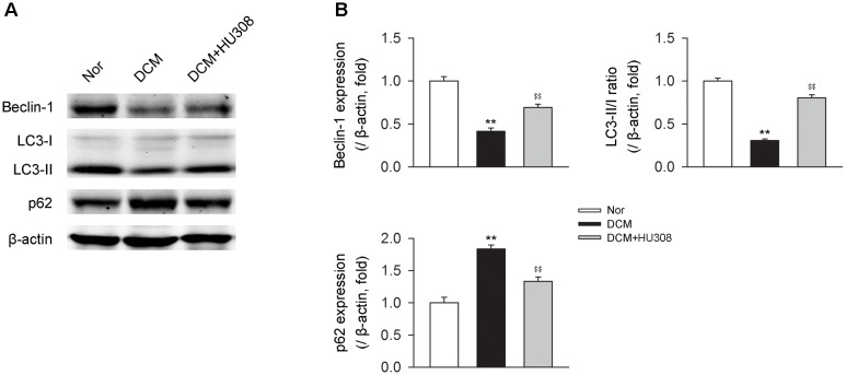 Administration of HU308 enhances cardiac autophagy in heart issues from DCM mice. (A) Representative images of the autophagy-related proteins including beclin-1, LC3-II/I, and p62. (B) Quantitative analysis of the autophagy-related proteins (n = 5). ∗∗P < 0.01 vs. Nor group; $$P < 0.01 vs. DCM group. Nor, normal; DCM, diabetic cardiomyopathy.
