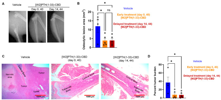 Radiographic and histological analysis revealed reduced osteolytic lesions by bone-targeted PTH antagonist [W2]PTH 1-33 CBD. (A) A Representative radiograph at day 60 of mice hindlimb from an intra-iliac experiment with three groups was shown. Group 1, vehicle; Group 2, [W2]PTH(1-33)-CBD was administered subcutaneously at a dose of 1000 µg/kg at day 0 and day 40 after tumor cell inoculation; Group 3, [W2]PTH(1-33)-CBD was administered subcutaneously at a dose of 1000 µg/kg at day 14 and day 44 after tumor cell inoculation. (B) The osteolytic lesion area was quantitated from X-ray images using image J. All values shown are mean ± SEM, n = 5 mice per group * p < 0.05, compared to vehicle; ns, not significant. (C) H&E images show that tumors occupy most of the area of the hind limb in the vehicle group, and [W2]PTH(1-33)-CBD treated protected bone robustly from tumor destruction. (D) The bar graph shows the percentage tumor burden in bone measured using ImageJ software. * p < 0.05.