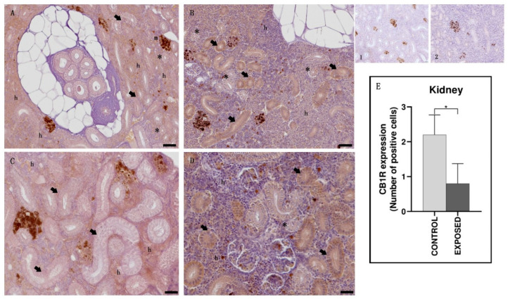 Light micrographs of eel kidney. Immunoreactivity to CB1R. (A,C): control specimens; (B,D): exposed specimens. Insets: 1, 2: negative control of (A,B), respectively. In the control specimens (A,C), the hematopoietic (h) tissue appeared immunopositive to CB1R, while the proximal (arrow) and the distal (asterisk) tubules) were not. In the exposed specimens (B,D), the immunopositivity of the hematopoietic (h) tissue appeared absent/faint, while the proximal (arrow) tubules were generally immunopositive, and the distal (asterisk) tubules were generally not. m: melanomacrophage centers. Scale bar: (A,B): 0.050 mm; (C,D): 0.020 mm. (E): semi-quantitative analysis of immunoreactivity. The Mann–Whitney test showed a statistically significant difference among the control and the exposed specimens. * p < 0.05 (0.0159).