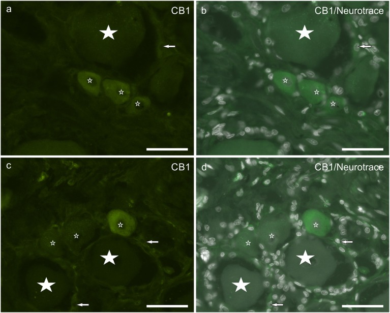 (a–d) Photomicrographs of cryosections of canine cervical (C8) dorsal root ganglion showing cannabinoid receptor 1 (CB1) immunoreactivity. Small stars indicate small neurons showing CB1 receptor weak to moderate immunoreactivity. Large stars indicate CB1 receptor negative. Arrows indicate satellite glial cells showing weak CB1 receptor immunoreactivity. Bar: a–d = 50 μm.