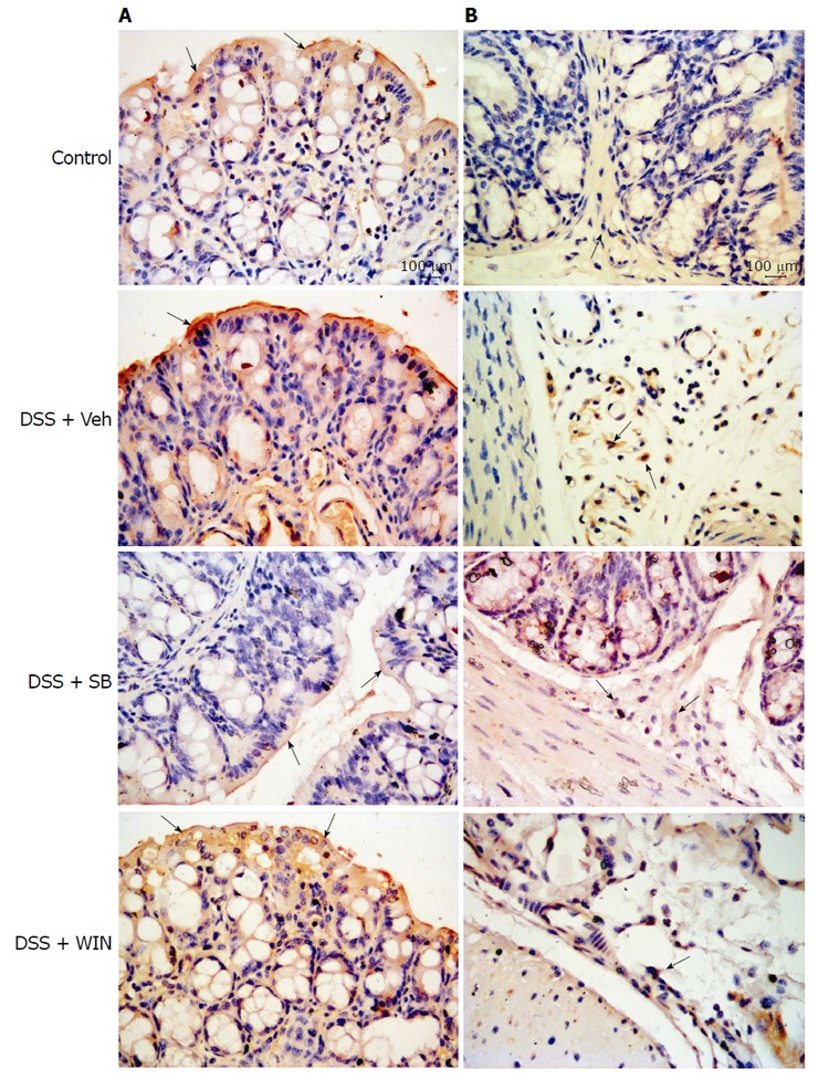 Representative figures of the expression of cannabinoid receptor type 1 and type 2 receptors in mouse colon by immunohistochemistry staining, which are from 4 separate experiments with similar results. A: Expression of cannabinoid (CB)1 receptors; B: Expression of CB2 receptors; (magnification × 400, respectively). The expressions of CB1 receptor in the colonic epithelial cells and CB2 receptor in the submucosal immune cells are marked by arrows and presented as positive results with brown-yellow staining.