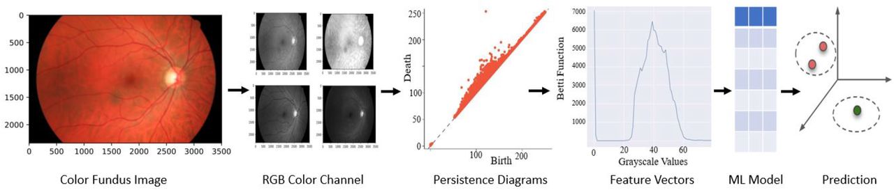 Flowchart of Topo-ML modelWe start with fundus images, extract RGB and Gray color spaces, and then create persistence diagrams from color values. Topological feature vectors (Betti functions) are derived from these diagrams and fed into machine learning models like RF, XGBoost, and kNN, resulting in highly accurate classifications.