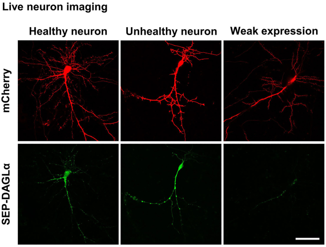 Representative live images of a healthy neuron (left) and an unhealthy neuron (center)A healthy neuron that weakly expresses SEP-DAGLα (right) is also shown. Scale bar, 50 μm.