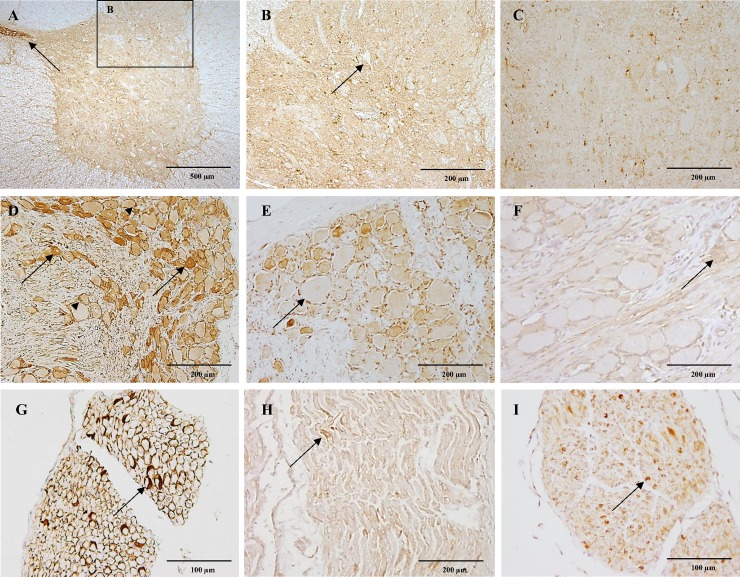 CB1 immunoreactivity in the spinal cord, dorsal root ganglia and peripheral nerve.In figure A, strong CB1 immunoreactivity is shown in the grey matter of the cervical spinal cord of a six-month-old dog and the cytoplasm of ependymal cells lining the central canal (A; arrow). Within the dorsal horn, CB1 immunoreactivity appears surrounding unstained neuronal bodies (B; arrow). In the cervical spinal cord of a ten-year-old dog notice slight immunoreactivity of the grey matter (C). Figure D showing the cervical dorsal root ganglia of a six-month-old dog with slight immunoreactivity of large neurons and strong CB1 immunoreactivity of small dark neurons (arrows) and satellite cells (arrowheads). The thoracic dorsal root ganglia of a ten-year-old dog with moderate CB1 immunoreactivity of small dark neurons and satellite cells, large neurons show slight immunoreactivity (E; arrow). The cervical dorsal root ganglia of a four-week-old dog depicting scattered large and small neurons and satellite cells with slight CB1 immunoreactivity (F; arrow). In figure G the cervical spinal nerve of a six-month-old dog shows strong CB1 expression in Schwann cells ensheating axons (arrow). Few Schwann cells show moderate CB1 immunoreactivity (arrow) in a thoracic spinal nerve of a ten-year-old dog (H). The cervical spinal nerve in the four-week-old dog shows moderate CB1 immunoreactivity of scattered Schwann cells (I; arrow). IHC was performed using the avidin-biotin-peroxidase complex (ABC) method.