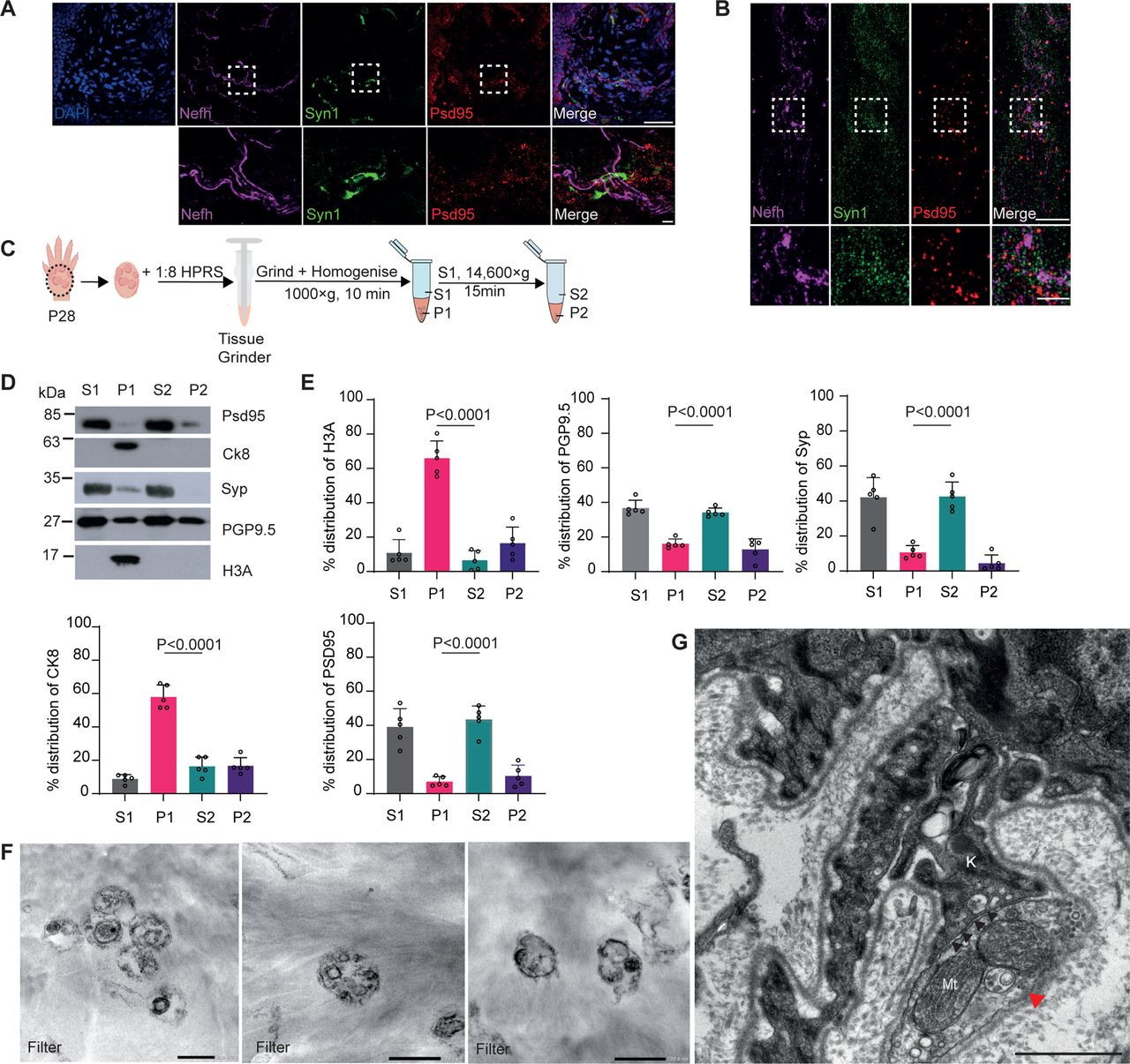 Isolation of peripheral terminals from mouse footpad.(A and B) Confocal and SIM images of mouse epidermis stained with Nefh, Syn1 (Synapsin 1), Psd95 (post-synaptic density 95), and DAPI show a synapse-like structure. Scale bars: 50 µm and 5 µm (magnified areas). (C) Schematic showing peripheral nerve isolation from P28 mouse footpad by subcellular fractionation using HPRS: HEPES protease RNAse, and sucrose buffer. (D) Representative immunoblot of enrichment of synaptic markers, PSD95, Syp1, and PGP9.5 in the S2 fraction. (E) Quantification of synaptic and nuclear proteins in different fractions after subcellular fractionation in (D) One-way Anova with Tukey’s multiple comparisons tests. Data are meanL±Ls.d. of nL=L5 biological replicates. (F) Representative image of mouse footpad epidermis showing contact site (black arrowheads) between peripheral nerve terminal (red arrowhead), and keratinocyte (K), Mitochondria (Mt). Scale bar: 500 nm. (G) Representative electron micrographs of isolated peripheral terminals following fractionation immobilised on polycarbonate filter. Scale bar: 200 nm.