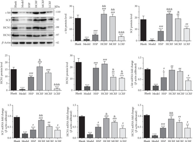 The expressions of c-kit, SCF, HCN1, and HCN2 mRNA and protein in the transverse colon of rats. (a) The protein levels of c-kit, SCF, HCN1, and HCN2 in the transverse colon of rats were detected by Western blotting. The relative quantitative histogram of (b) c-kit, (c) SCF, (d) HCN1, and (e) HCN2 protein levels in the transverse colon of rats. The mRNA levels of (f) c-kit, (j) SCF, (h) HCN1, and (i) HCN2 in the transverse colon of rats were detected by RT-PCR. HSP: hemp seed pill group; HCRF: high-dose CRF group; MCRF: medium-dose CRF group; LCRF: low-dose CRF group. ⁣∗p < 0.05, ⁣∗∗p < 0.01, ⁣∗∗∗p < 0.001 vs. blank; #p < 0.05, ##p < 0.01, ###p < 0.001 vs. model; and &p < 0.05, &&p < 0.01, &&&p < 0.001 vs. HSP.