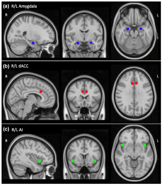 ROIs in MNI152 template space. (a) Bilateral amygdala (R: 24.1, −8.05, −20.06; L: −23.5, −6.73, −19.7). (b) Bilateral dACC (R: 7.35, 19.98, 29.06; L: −6.8, 21.32, 28.29). (c) Bilateral AI (R: −38.97, 12, −8.11; L: 44.54, 13.44, −7.51).Six millimeters Seed Regions of Interest (ROI) were used for the rsFC analyses. R: right; L: left; dACC: dorsal anterior cingulate cortex; AI: anterior insula; Each seed ROI was defined as a 6 mm sphere created using NiftiSphereMasker from Nilearn 0.9.0 in standard MNI152 template space.