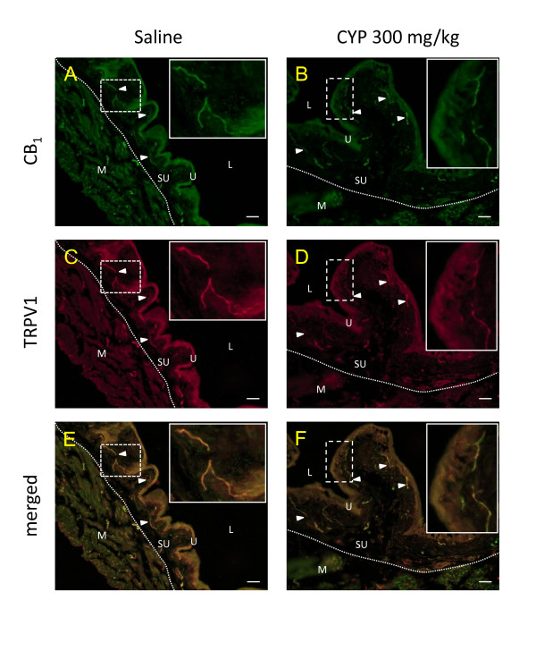 Bladder immunoreactivity for CB1 receptor (A, B) and TRPV1 (C, D). Mice were injected with saline (control, A, C and E) or cyclophosphamide (CYP, B, D and F) 300 mg/kg two hours before tissue harvest. Arrowheads = nerve fibres which co-express CB1 receptors and TRPV1, U = urothelium, L = lumen, dotted line = separation between the suburothelial (SU) and the muscular (M) layers. The boxes focus on the co-expression of CB1 with TRPV1 in fibers of the suburothelium layer, scale bar = 20 μm.