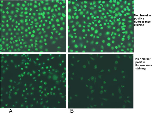 Representative fluorescent photomicrograph of blood monocyte-derived macrophages (BMDMs) from autistic patients showing immunocytochemistry (green fluorescent) for Notch (top) and Ki67 markers (bottom). To correctly identify cells, their nuclei were counterstained with bisbenzimide (blue fluorescence). (A) untreated BMDMs; (B) GcMAF treated BMDMs.