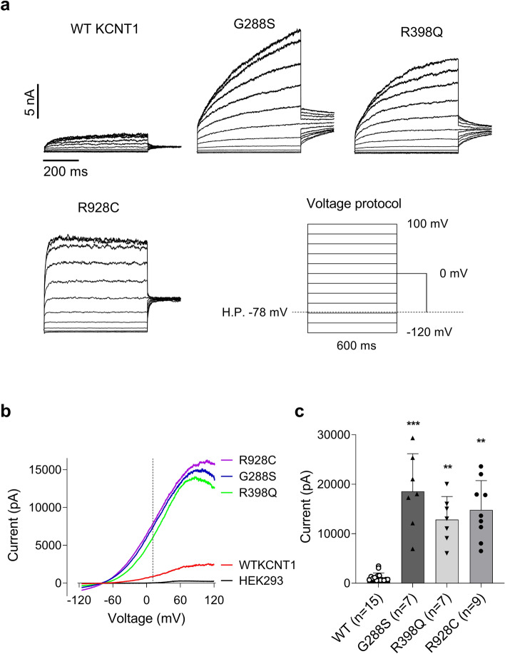WT and mutant KCNT1 currents recorded in HEK293T cells. (a) KCNT1 currents recorded in HEK293T cells in response to the voltage steps ranging from − 120 mV to 80 mV in 20 mV increments followed by a voltage step to 0 mV. (b) Examples of the I-V plots of WT and mutant KCNT1 currents recorded in response to 100 ms voltage ramps between − 120 and 120 mV. For comparison, an example of the I-V plot recorded in non-transfected HEK293T cell is shown. The vertical dash line corresponds to 10 mV. (c) The average amplitudes of the WT and mutant KCNT1 currents measured at 10 mV using the I–V plots recorded in response to the voltage ramps between − 120 and 120 mV, similar to those shown in panel (b). Brown-Forsythe and Welsh’s one-way ANOVA followed by Dunnett's multiple comparisons test indicated that currents produced by the mutant constructs were significantly larger, compared to WT KCNT1 (P = 0.0003 (G288S); P = 0.0017 (R398Q) and P = 0.0026 (R928C)).
