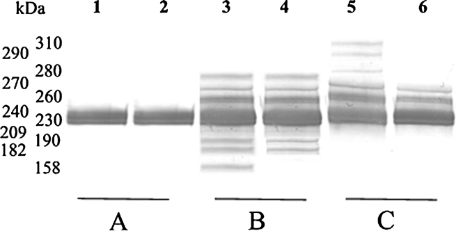 Representative immunoblot patterns of plasma FN. SDS–PAGE in 7.5% gel was done under reducing conditions. The immunoblots were developed with monoclonal antibody anti-CBDFN. A, B and C pattern types (quantitatively characterized in Table 3) represent immunoblotting of plasma samples: 1—normal, 2—RA, 3–6—SLE