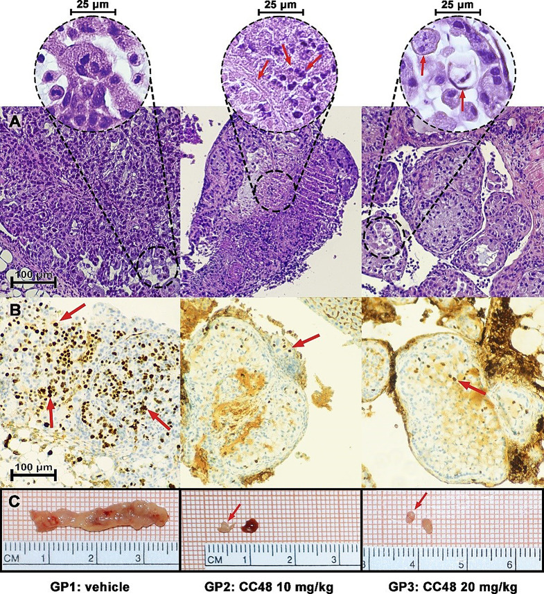 CC48 reduces tumor cells proliferation in treated mice (A) Histological sections stained with hematoxylin & eosin, representative of the tumor masses from each of the three experimental groups, vehicle-treated control group (GP1), group treated with 10 mg/Kg CC48 (GP2) and group treated with 20 mg/Kg CC48 (GP3) Lens: 10X. Bar: 100 μm. Circled areas enclose details of each histologic section taken at 40X magnification. In GP1 there are viable neoplastic cells, in GP2 the red arrow on the left indicates the necrotic area, and the two red arrows on the right indicate the lymphocytic infiltrate. In the GP3 group of mice, where the malignancy infiltrates the striated muscle of the murine diaphragm, the left arrow indicates a foamy histiocyte with fragmented nucleus, the right arrow indicates another foamy histiocyte with pyknotic nucleus (hydropic degeneration of tumor tissue) Lens: 40X. Bar: 25 μm. (B) At Immunohistochemical analysis of the intra-tumoral Ki67 marker as an index of cell proliferation, we calculated a mean of 35% of Ki67 stained nuclei in GP1 and a mean of 15–20% in GP2/GP3 (*p < 0.05 GP3 vs. GP1). Red arrows indicate some Ki67 positive nuclei. Lens: 10X. Bar: 100 μm. (C) The sampled tumor masses were photographed on graph paper. Images are representative of each treatment group
