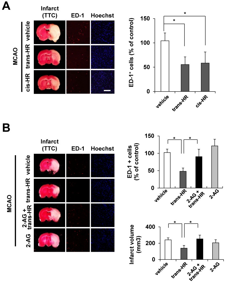 Post-treatment of hinokiresinols significantly reduced ED-1-postive microglia/macrophages in ischemic lesions.Rats were subject to MCAO for 90 min and then reperfused. After 24 h, coronal brain sections were stained with triphenyltetrazolium chloride (TTC) for brain infarct, anti-ED-1 antibody to detect macrophages/monocytes/activated microglia (red), or Hoechst for nuclei staining (blue). Data are presented as mean ± SEM. Scale bar = 50 μm. * P < 0.05: vs. indicated group. (A) Trans- or cis-hinokiresinol (10 mg/kg, i.p.) was administrated at 2 h and 7 h after the onset of MCAO. Representative images (left panel) and quantification of cell counts of ED-1-positive cells (right panel) are provided. N = 3–5. (B) Co-administration of 2-AG abolished the protective effect of trans-hinokiresionol. Trans- hinokiresinol was administrated in the presence or absence of 10 mg/kg 2-AG (once at 2 h after starting MCAO, i.v.). Representative images (left panel) and quantification (right) of either cell counts of ED-1-positive cells (upper) or infarct volume (lower) are provided. N = 4–7.
